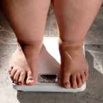 Când slăbitul nu mai depinde doar de dietă. Semnele care pot indica faptul că obezitatea necesită tratament medical