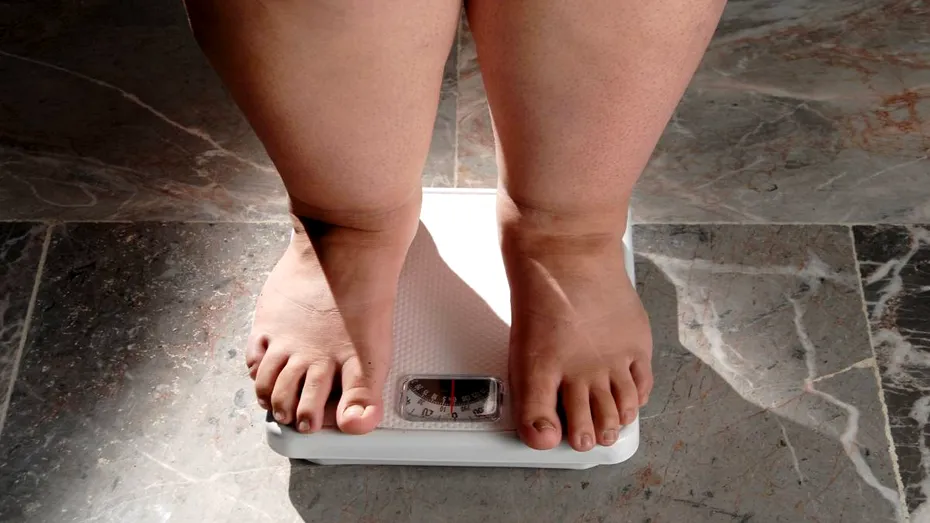 Când slăbitul nu mai depinde doar de dietă. Semnele care pot indica faptul că obezitatea necesită tratament medical